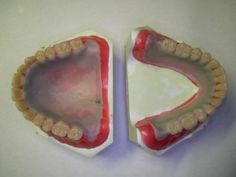 白金加金17〜18K 金属床模型サンプル 歯科技工 ゴールド床 X線